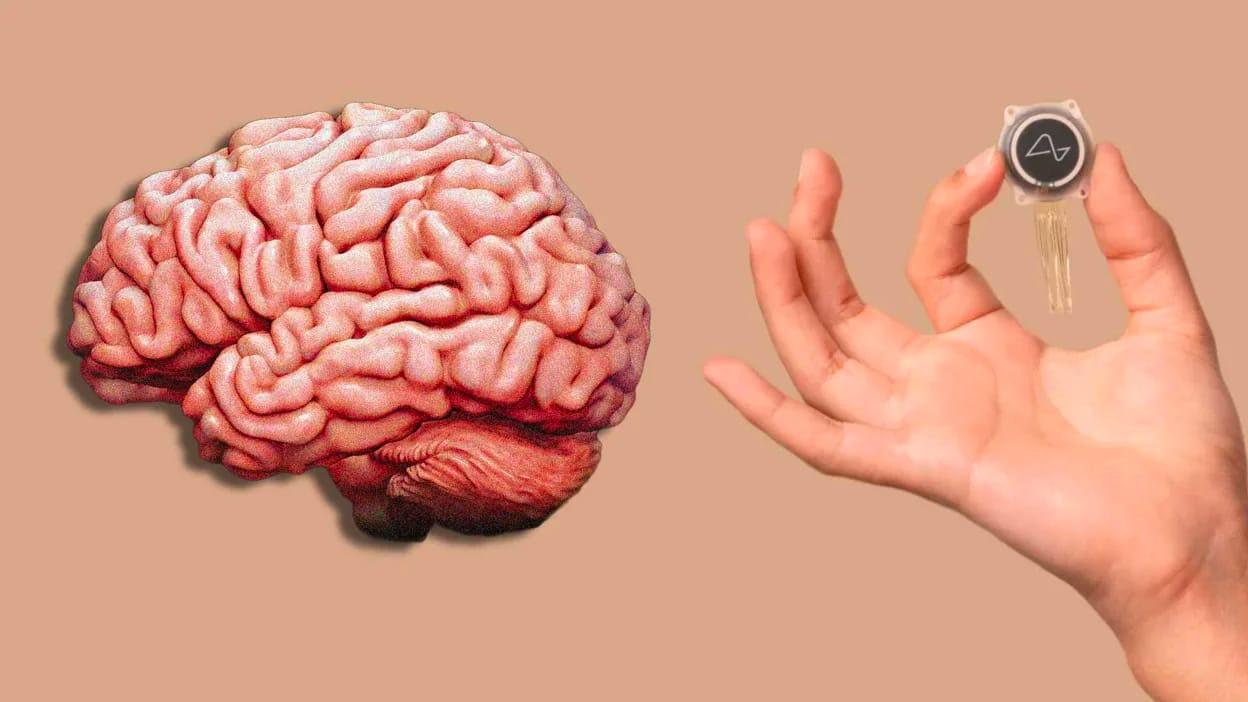 Primeiro chip cerebral da Neuralink é implantado em humano