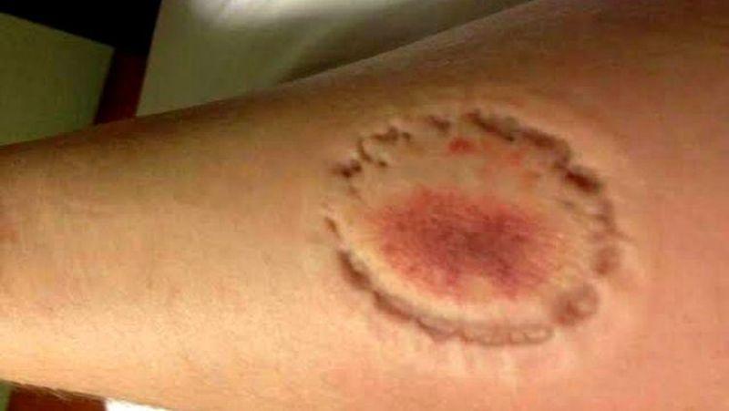 Briga por dívida de tráfico deixa homem ferido em Jandaia do Sul