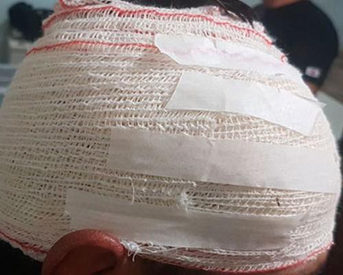 Homem é agredido e fica com corte de 20cm na cabeça em Apucarana
