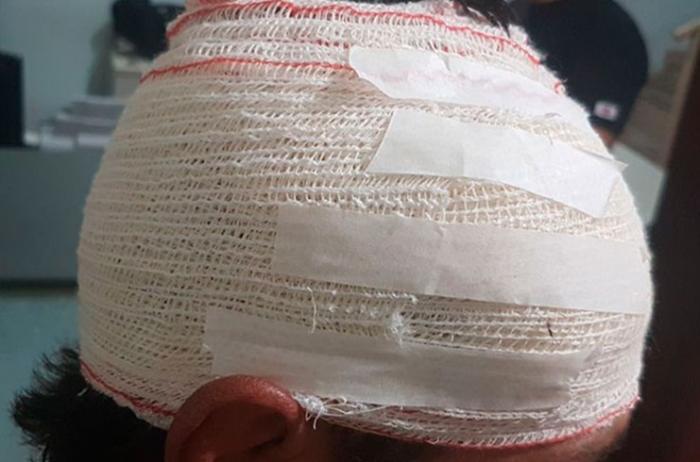 Colega de trabalho ataca vítima adormecida com paulada na cabeça em Apucarana