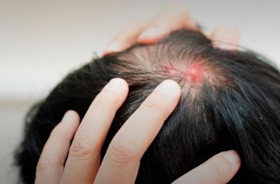 Homem de 36 anos sofre traumatismo craniano após agressão em Apucarana