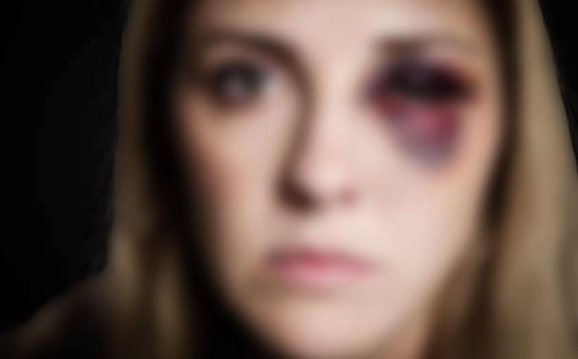 Mulher é agredida pela filha em Borrazópolis e sofre corte na cabeça