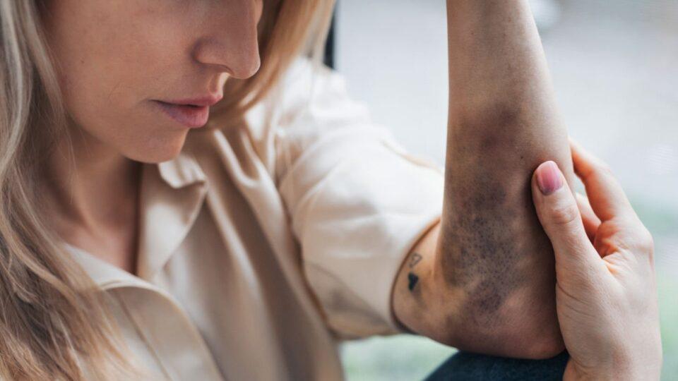 Mulher sofre lesões em caso de violência doméstica em Rosário do Ivaí