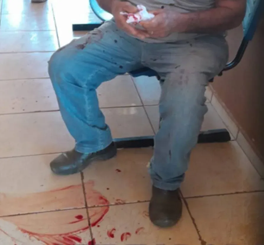 Vereador de Cambira é acusado de agredir idoso de 74 anos com soco na nuca