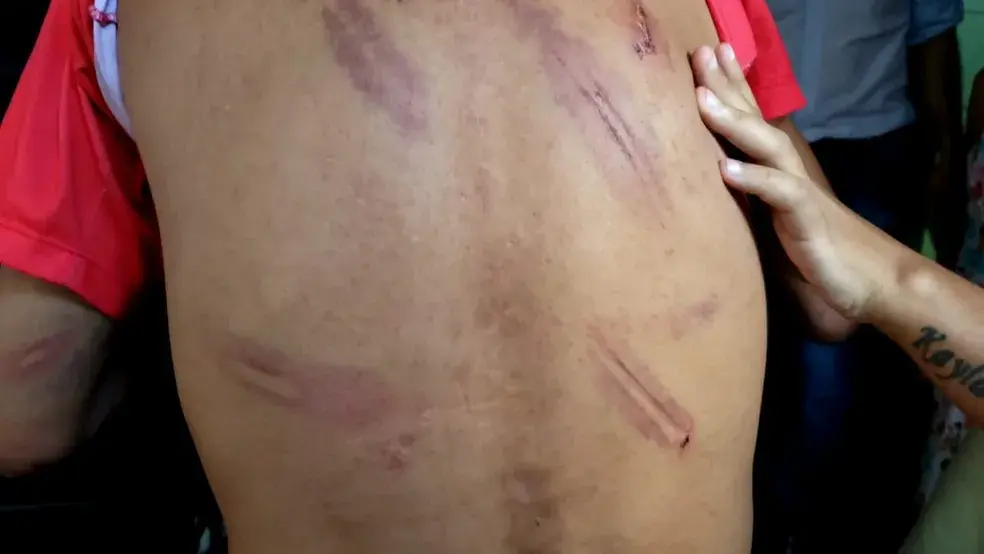 Homem sofre lesão corporal grave após ataque de grupo de motociclistas em Ivaiporã