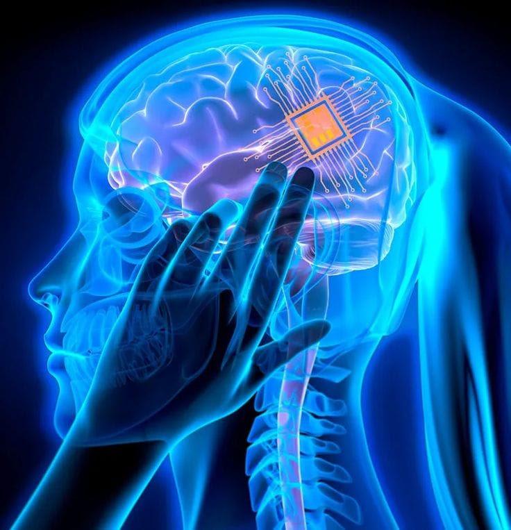 Motif Neurotech recebe autorização do FDA para testes clínicos de implante cerebral contra depressão